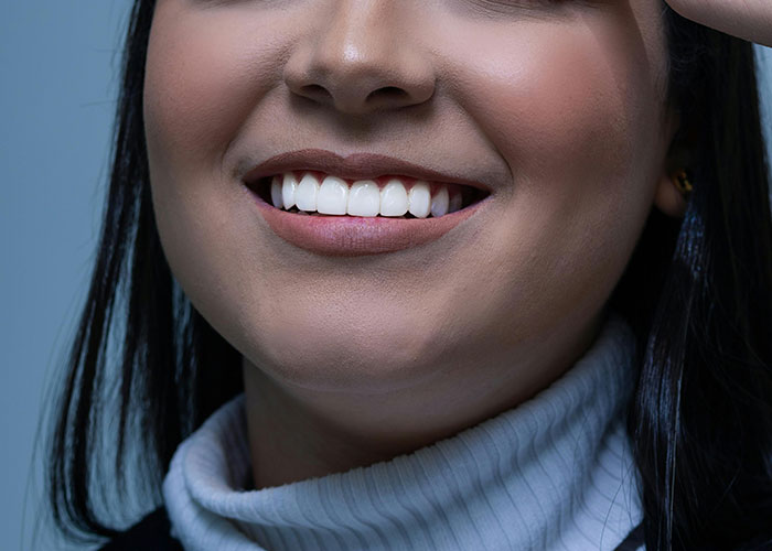 Close-up of a woman’s smile showing teeth and lips, highlighting cosmetic procedure results and potential concerns.