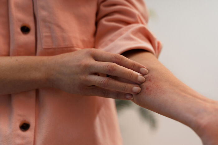 Person wearing a peach shirt gently touching a red rash on their inner forearm, illustrating terrifying medical conditions.