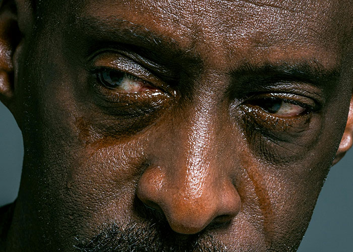 Close-up of a concerned man’s face showing emotional distress, illustrating mental health myths debunked by psychologists.