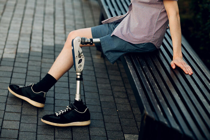 Person with a prosthetic leg sitting on a bench, highlighting experiences of people with disabilities facing ableist treatment.