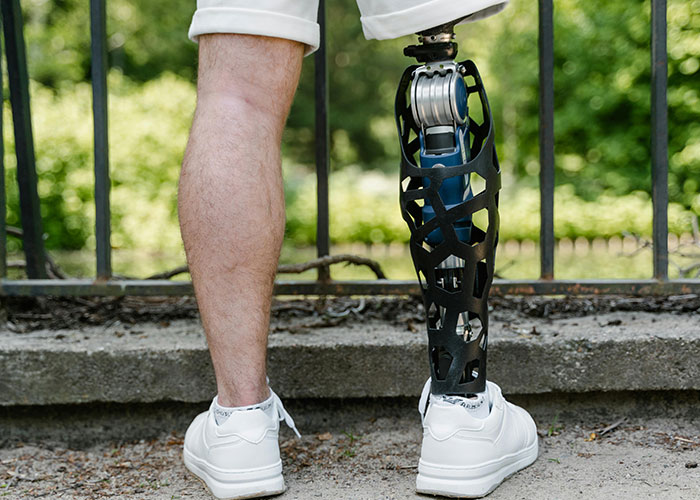 Man standing outdoors showing a modern prosthetic leg, highlighting moments kids said or did mortifying things.