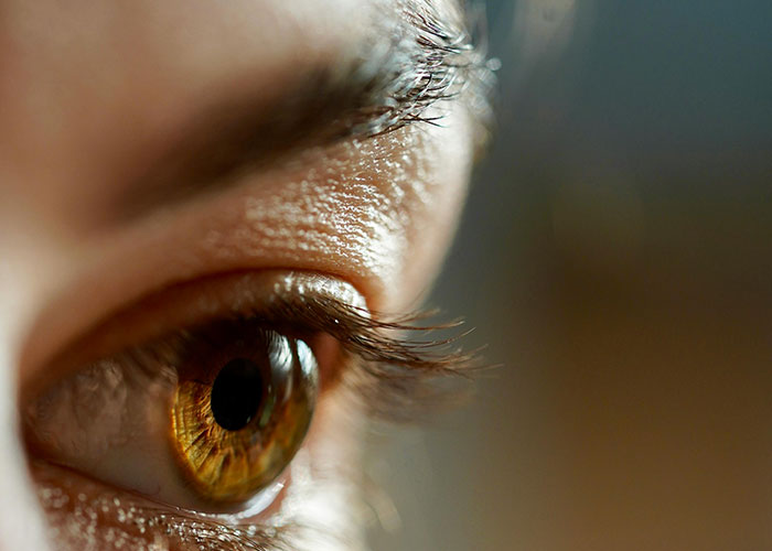 Close-up of a human eye showing detailed skin texture, highlighting effects seen after a cosmetic procedure.