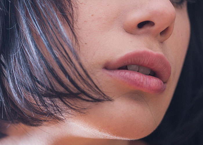 Close-up of a woman’s lips and chin showing natural skin texture, illustrating cosmetic procedure concerns and results.