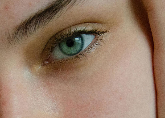 Closeup of a green eye and natural skin texture, illustrating concerns related to cosmetic procedure outcomes.