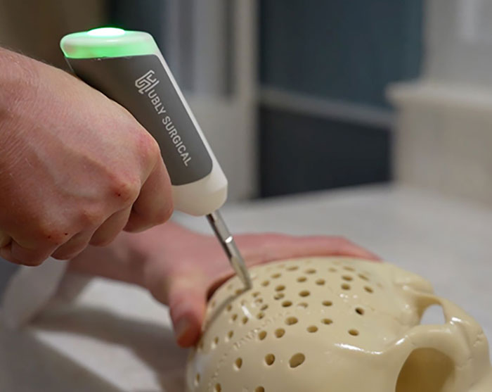 Hand holding a surgical drill device creating holes in a skull model related to brain surgeon arrest news.