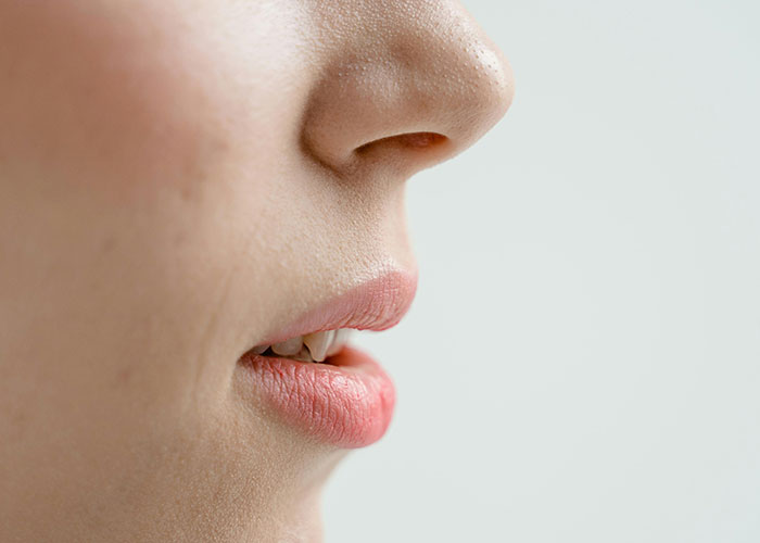Close-up of a person's lower face showing lips and nose, illustrating cosmetic procedure regrets and outcomes.