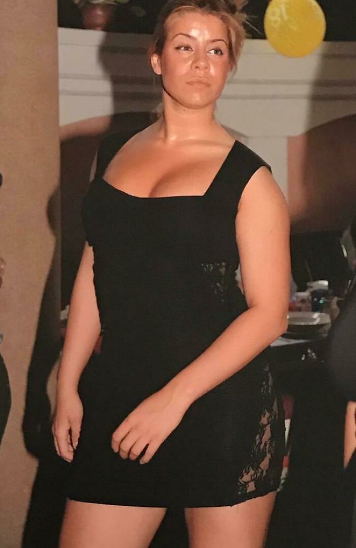 Woman in a black dress posing indoors, representing a plastic surgery enthusiast with multiple BBL procedures.
