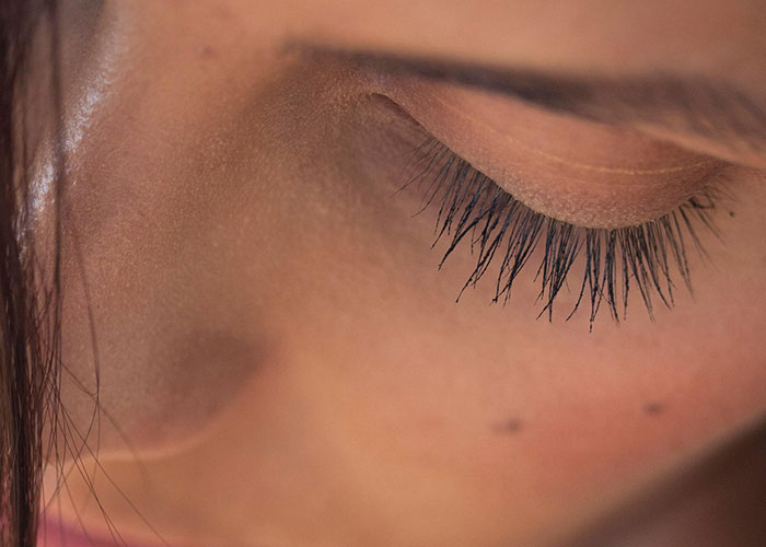 Close-up of a person's face with closed eyes, showing natural skin and eyelashes, relating to cosmetic procedure results.