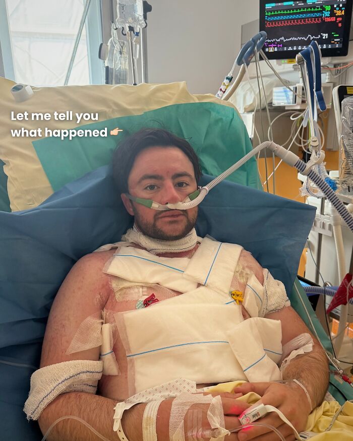 Man Who Swam For 110 Miles Without Sleeping Reveals "Intense" Hallucinatory Experience