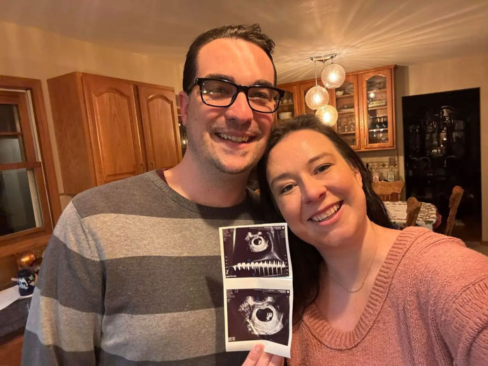 Couple smiling indoors holding ultrasound images, highlighting pregnant Disney superfan reported missing on Reddit.