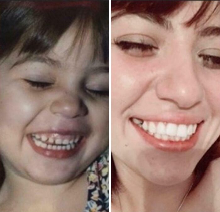 Side-by-side comparison of a smiling person showing how people looked back then and now in different decades.