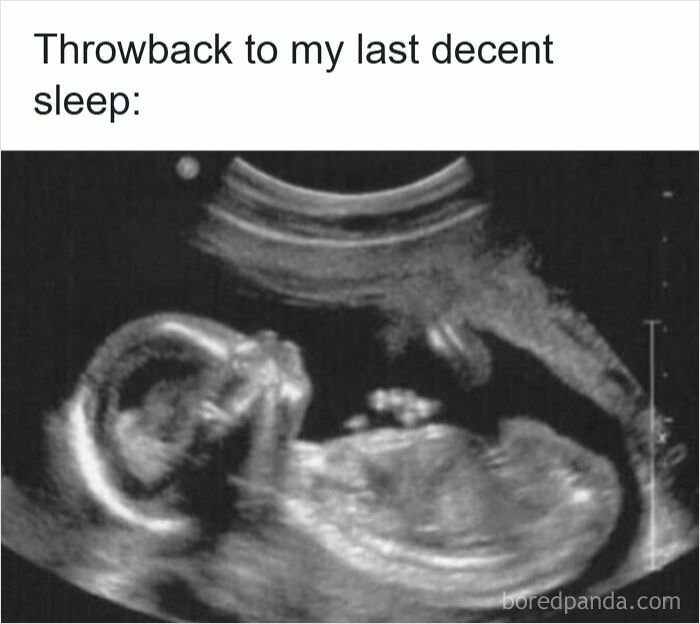 Ultrasound image with humorous caption about struggle to get decent sleep related to insomnia memes.