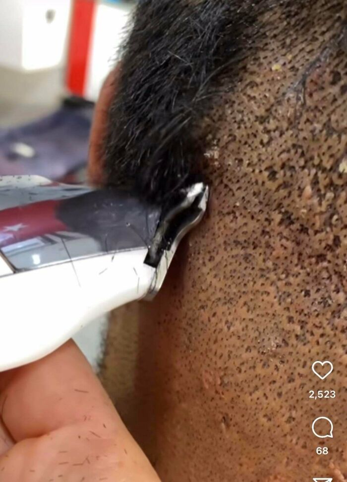 Close-up of a scalp with hair follicles during a haircut, showing a texture that may trigger trypophobia fears.