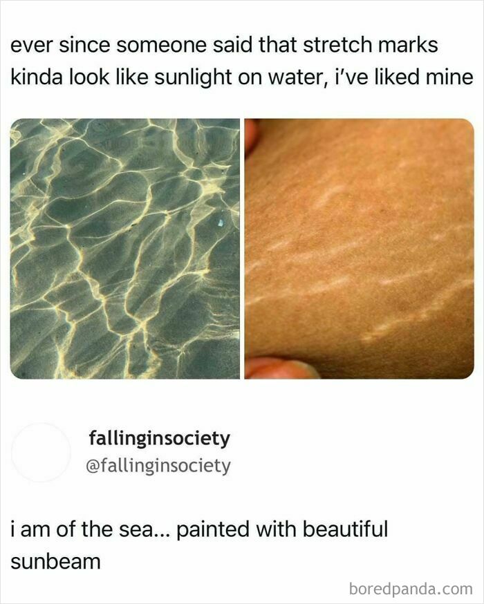 Sunlight reflecting on water compared to stretch marks on skin, highlighting natural beauty for a serotonin boost.