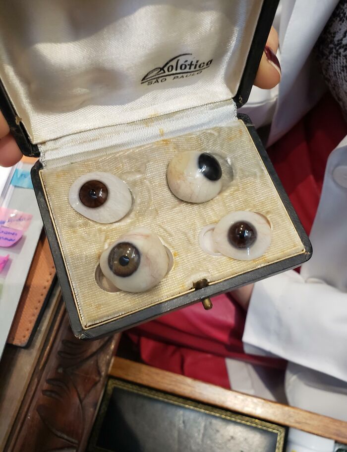 Set of vintage glass prosthetic eyes in a case, showing doctors’ creative tools to put patients at ease.