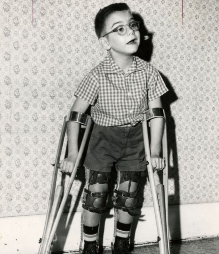 Vintage black and white photo of a boy with leg braces and crutches, a nostalgic image that makes people feel very old.