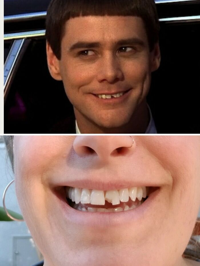 Close-up of a person with imperfect teeth haunted by Halloween fails, highlighting a spooky costume mishap.