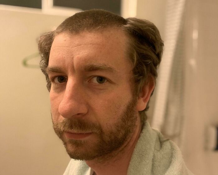 Man with a tragically funny hair accident showing unevenly shaved hair and a confused expression in a bathroom setting.