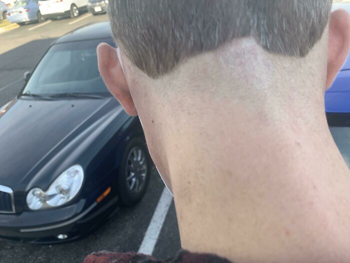 Close-up of the back of a person's head showing a hilariously tragic hair accident with an uneven haircut.