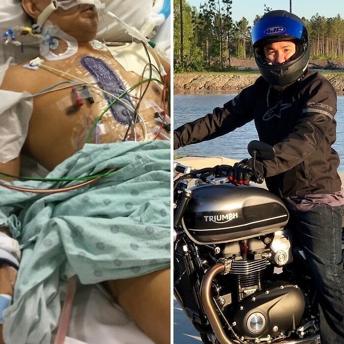 Paciente hospitalizado con múltiples electrodos y tubos, junto a persona con casco en motocicleta Triumph al aire libre.