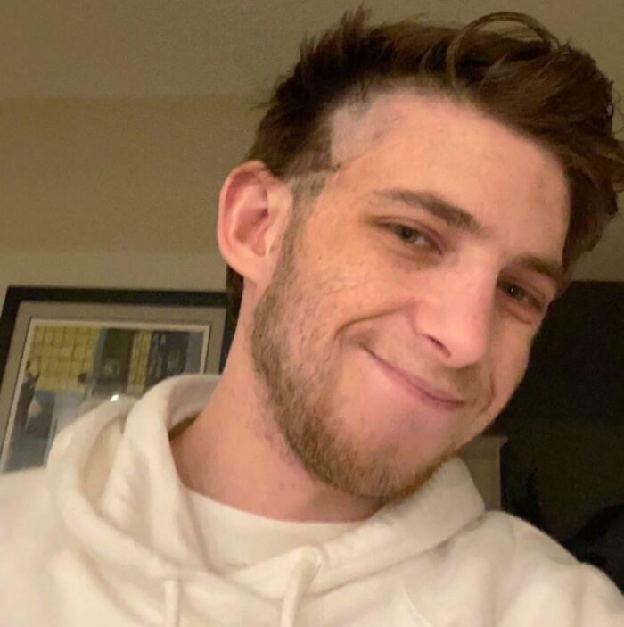 Young man smiling with a hilariously tragic hair accident showing a patchy uneven haircut and trimmed beard in a casual setting.