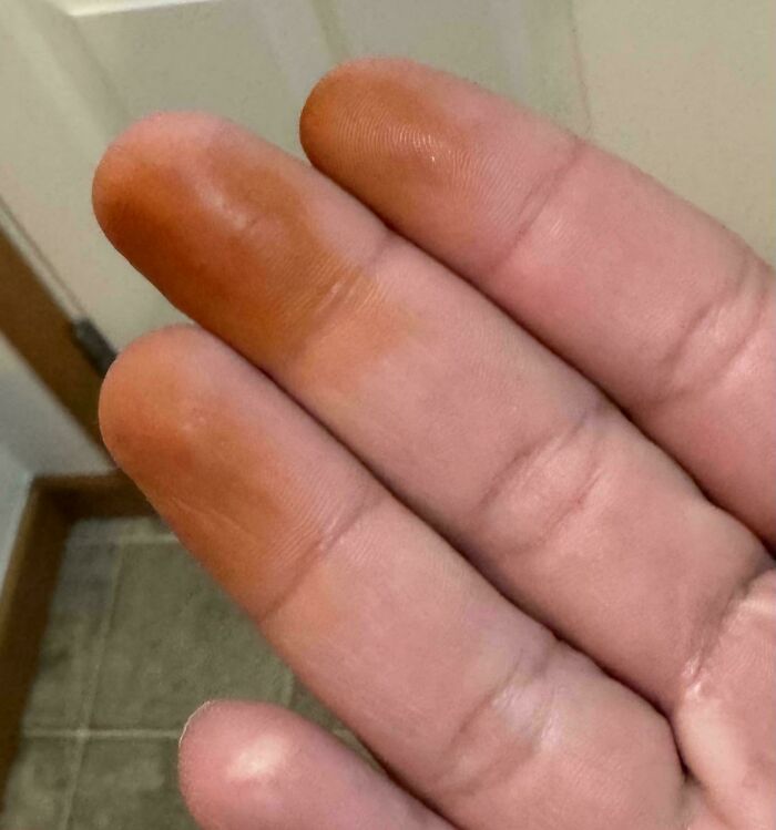 Close-up of fingers showing unexplained discoloration with orange stains on some fingertips in an interesting group photo.
