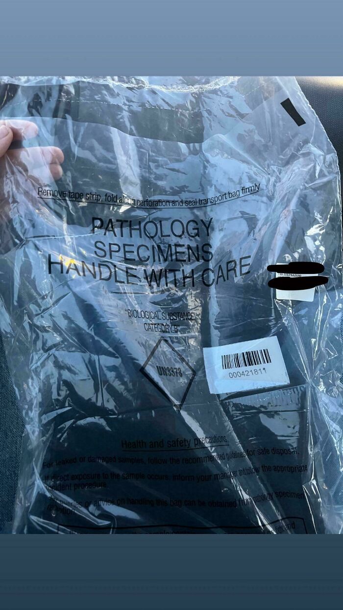 Clear plastic pathology specimens bag with handle with care warning and barcode, showcasing some things that cannot be explained.