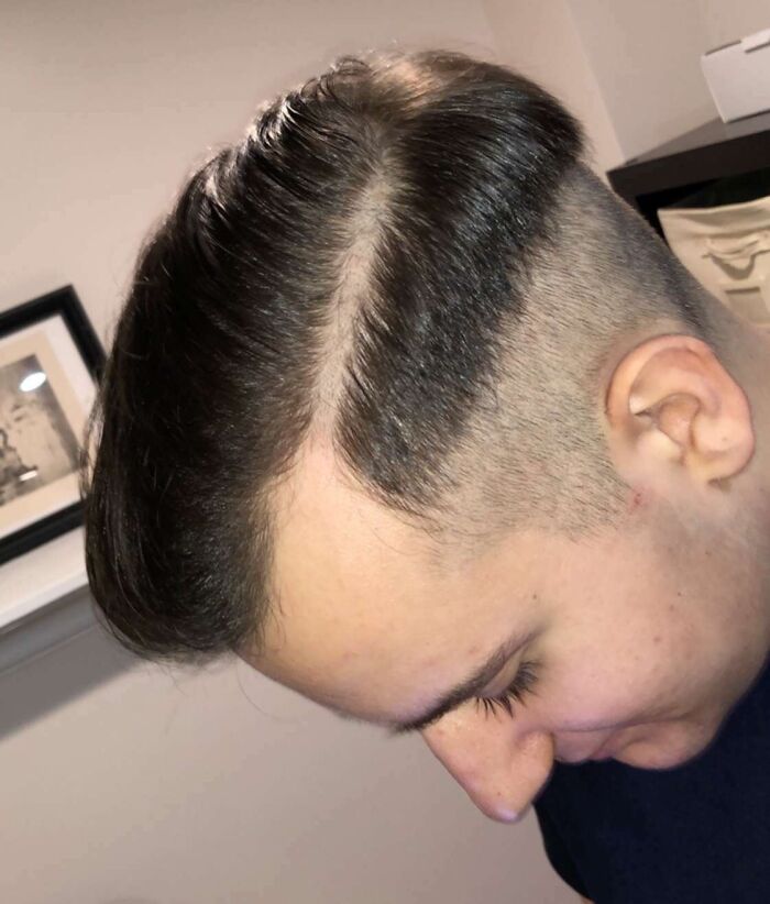 Man with a hilariously tragic hair accident showing uneven haircut with sharp contrast between long and shaved sections.