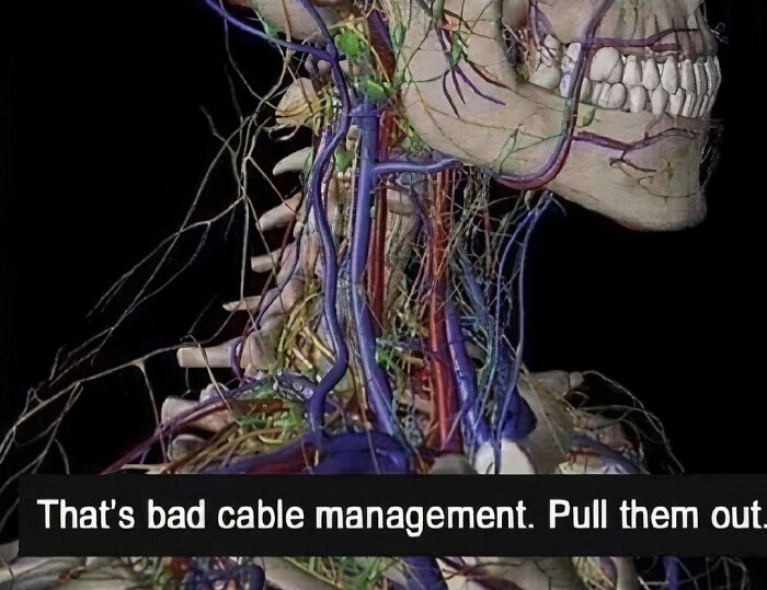 An anatomical illustration of the nervous system and blood vessels with a humorous caption about bad cable management.