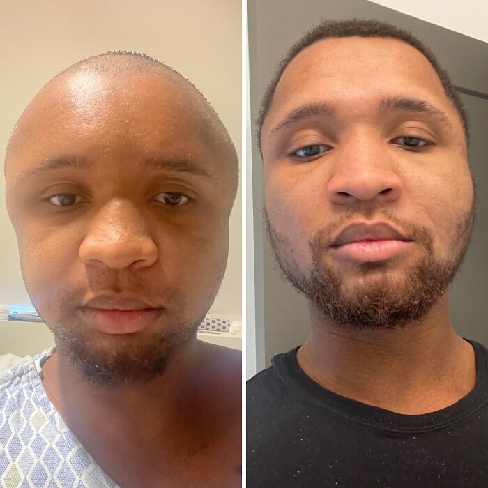 Side-by-side before and after photos showing a man's stunning transformation and complete reinvention of his appearance.