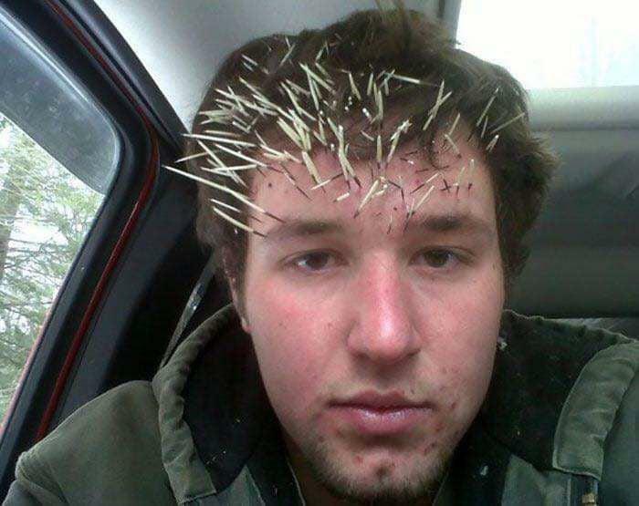 Young man with toothpicks stuck all over his forehead, a clear example of zero common sense in a car interior.