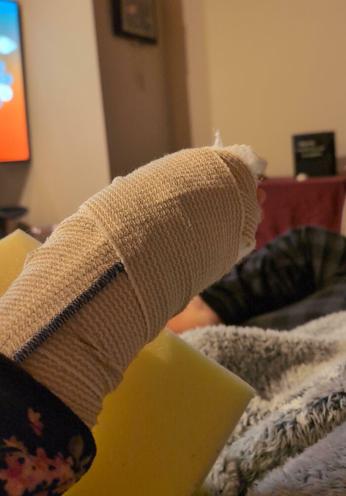 Person resting with a heavily bandaged hand and a yellow sponge, illustrating a total mess moment of injury and recovery.