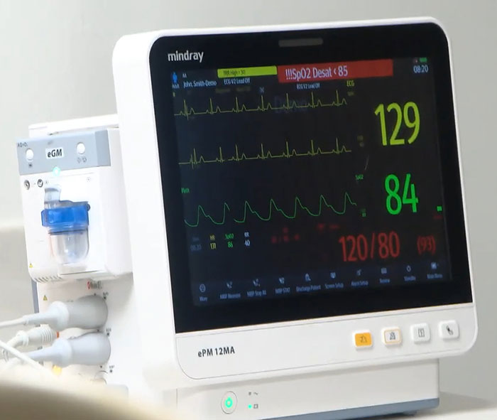 Medical monitor displaying vital signs during procedure involving morbidly obese patient at dental clinic.