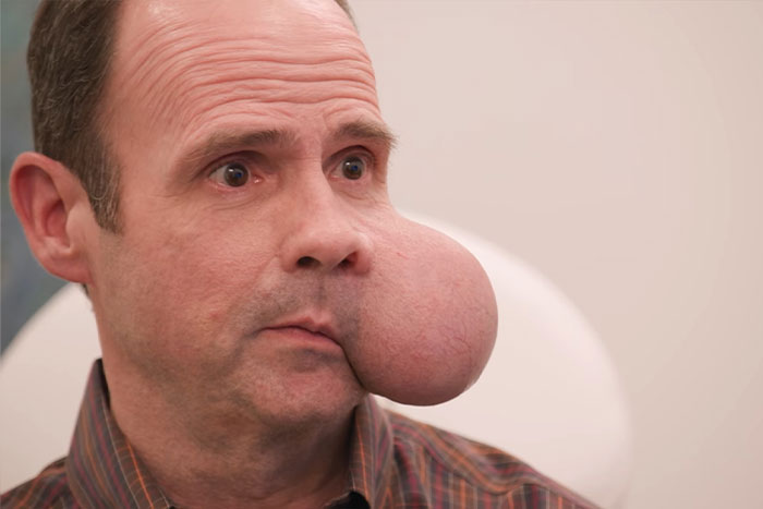 Man with large 4-lb face tumor sitting in medical office seeking urgent help after doctor issues fatal warning.