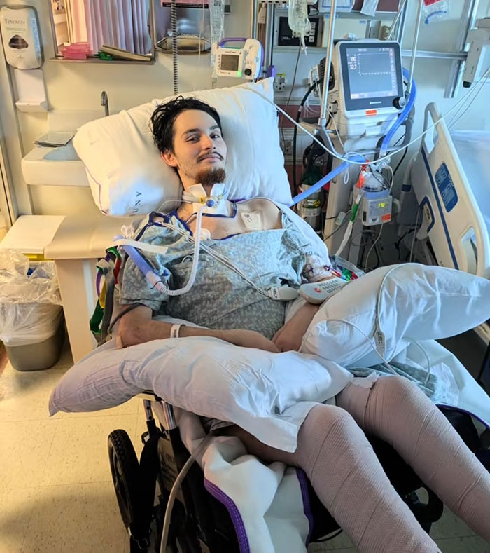 Young Florida dad-to-be in hospital bed with medical equipment after waking from coma, recovering with leg braces and pillows. Young Florida dad-to-be in hospital bed with medical equipment after waking from coma, recovering with leg braces and pillows.