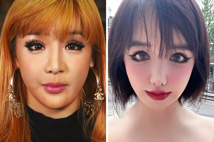 K-Pop icon Park Bom shown before and after her drastic plastic surgery transformation with notable makeup and hairstyle changes.