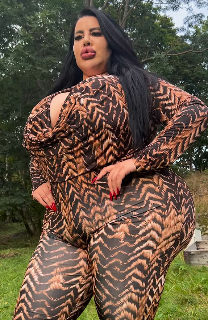 Woman posing outdoors in patterned outfit, showcasing results of multiple plastic surgery procedures including BBL enhancements.