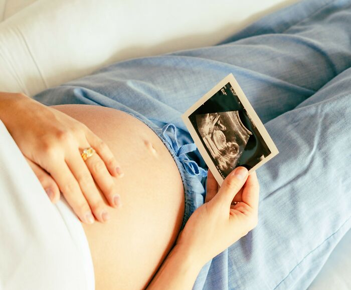 Pregnant woman holding ultrasound image while resting on a couch, highlighting pregnancy and friend with benefits concept.