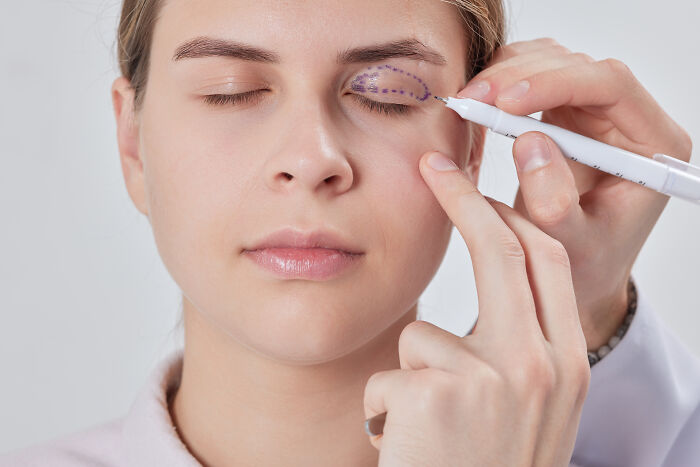 Woman with eyes closed having plastic surgery marks drawn around eyelid, highlighting plastic surgery speculation concept.