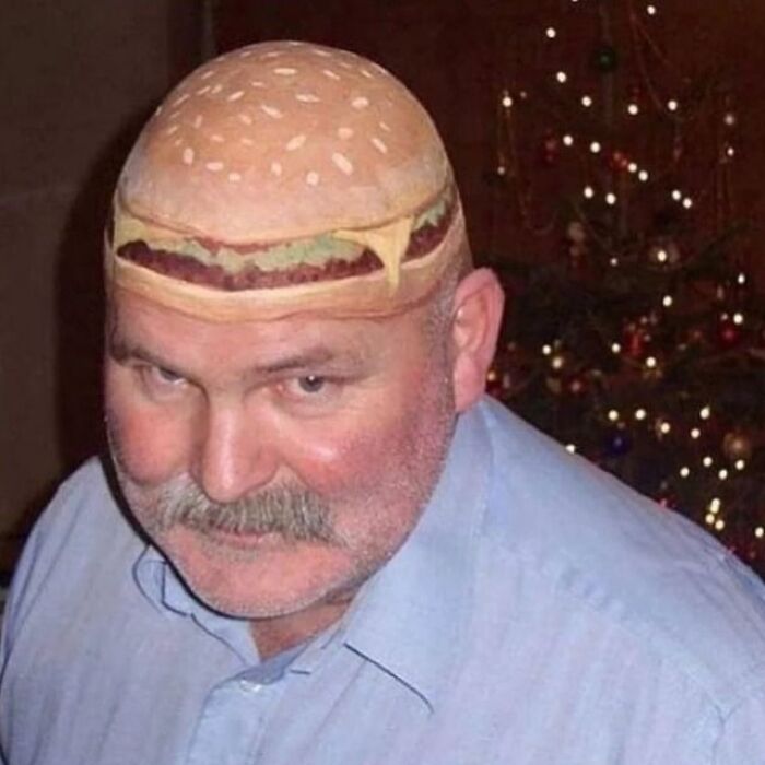 Man with a realistic hamburger tattoo on his bald head showcasing one of the 75 awful tattoos and poor decisions.