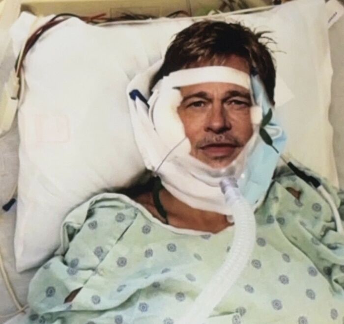 Man in hospital gown with wired headgear and breathing tube.