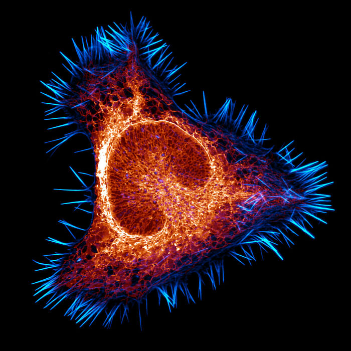 Microscopic image of a vibrant cell structure with blue spikes and glowing orange details from Nikon Small World contest.