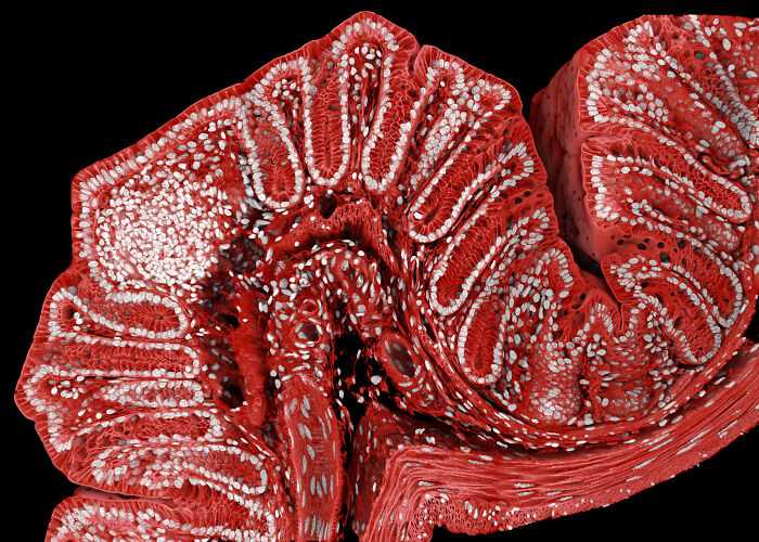 Microscopic image showcasing intricate red and white structures from the 2025 Nikon Small World photomicrography contest.