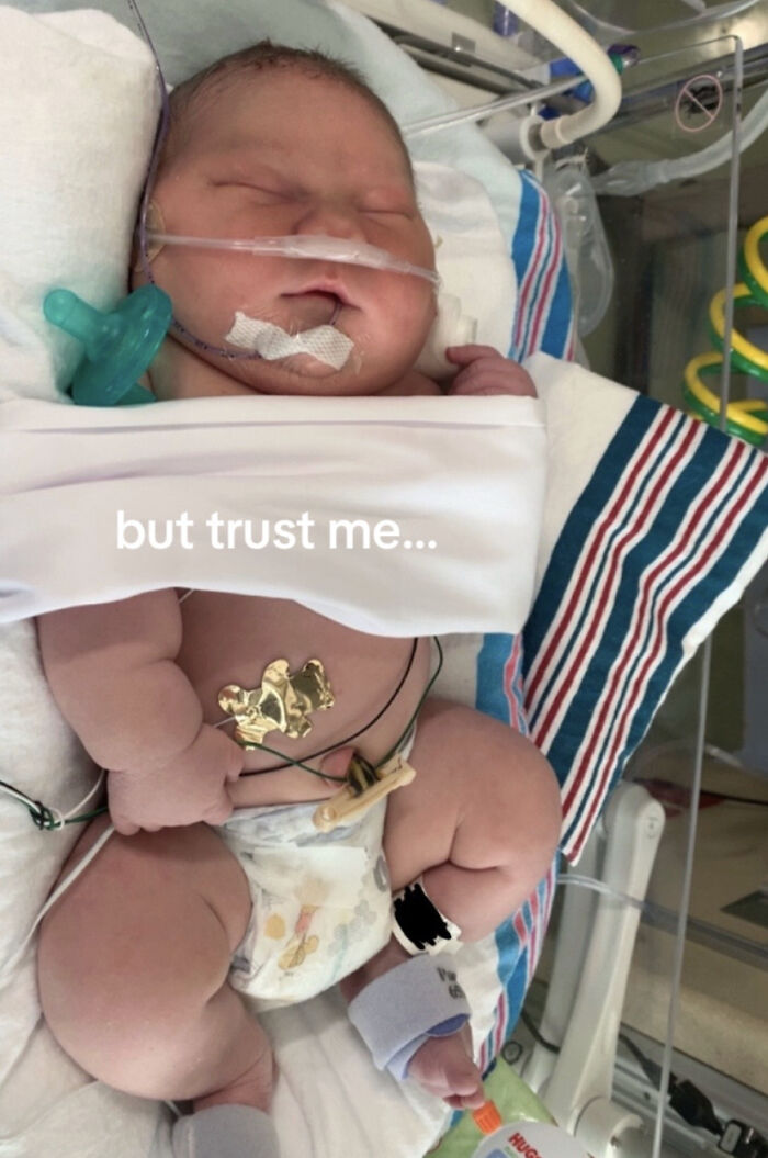 Newborn baby in hospital with medical tubes and monitors after breaking hospital record for largest birth. Newborn baby in hospital with medical tubes and monitors after breaking hospital record for largest birth.
