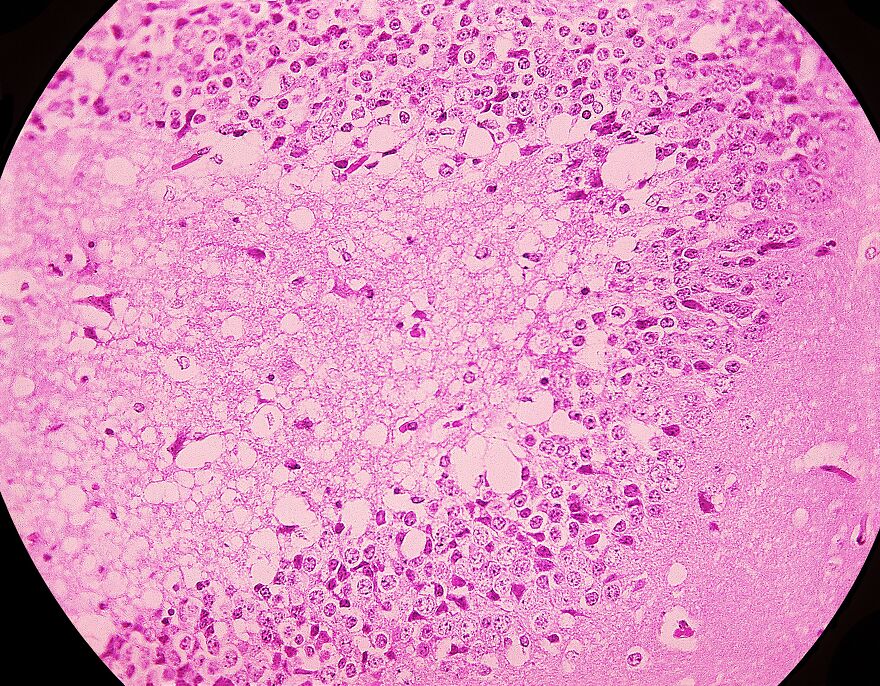 Microscopic view showing clusters of tiny holes and patterns related to trypophobia brain reaction concept.