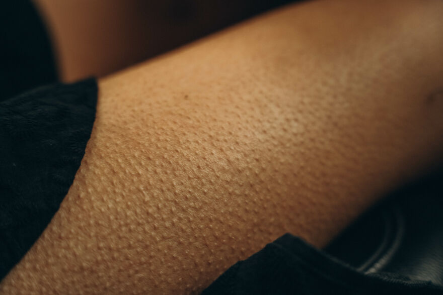Close-up of skin showing tiny holes resembling goosebumps, illustrating trypophobia reactions on the surface.
