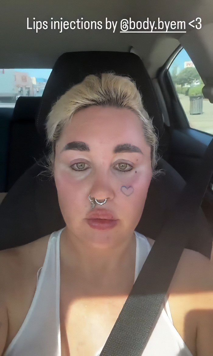 Amanda Bynes with lips injections and septum piercing showcasing new unrecognizable look in a car selfie.