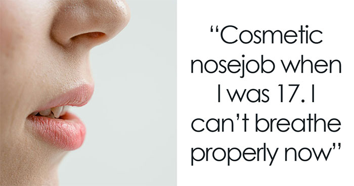 “It Looked Better Just Thick And Fat”: 45 Beauty Procedures People Regret Having Done