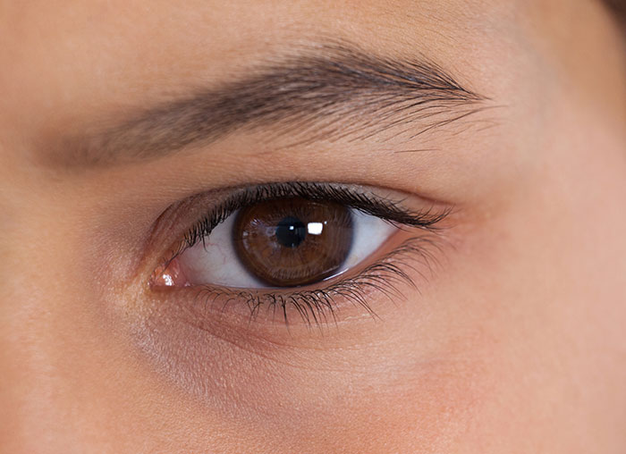 Close-up of a brown eye showing natural skin texture representing botched plastic surgeries and their effects on appearance.