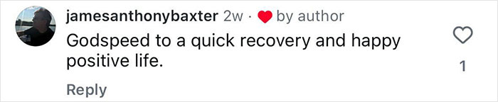 20-Year-Old Decided To Amputate His Leg After Going To A Rock Concert, Breaks His Silence On Why